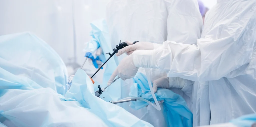 Laparoscopic Surgery Endometriosis